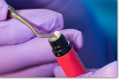 アートセラミック